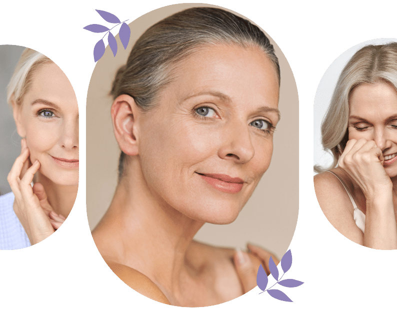 How to Soften Smile Lines