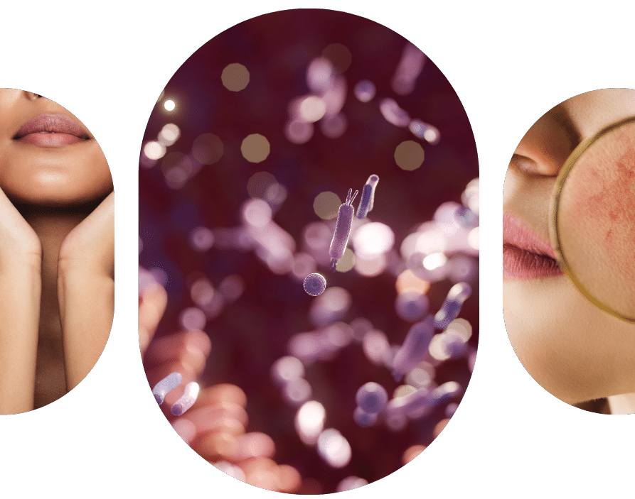 What is the microbiome and does it affect ageing?