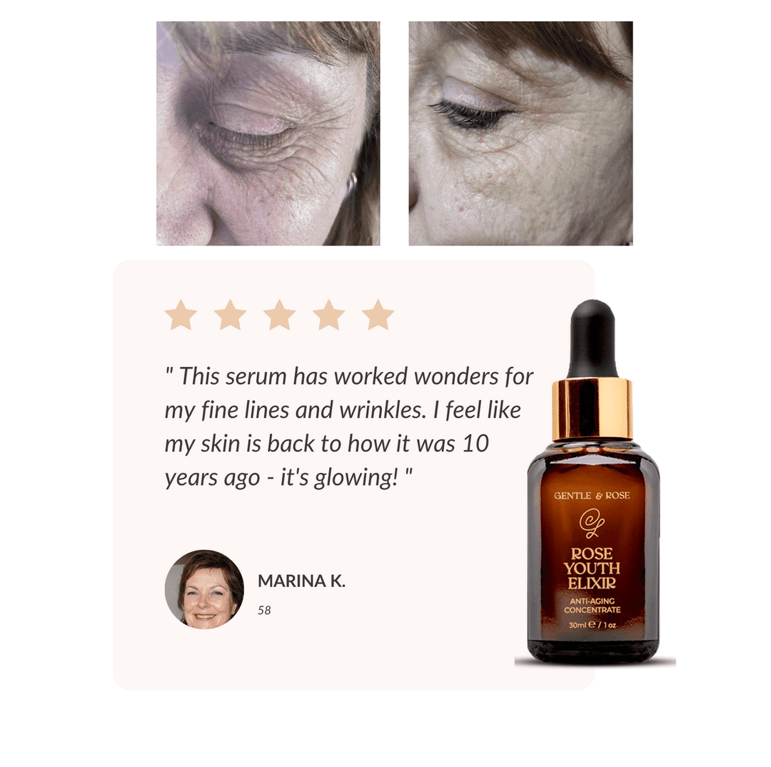 4 Ways the Rose Youth Elixir Will Transform Your Skin