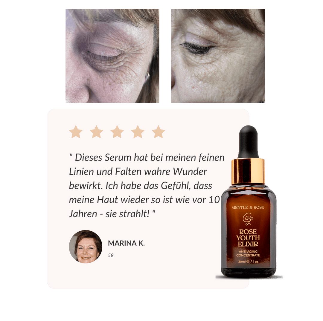4 Wege, wie das Rose Youth Elixir die Haut transformiert