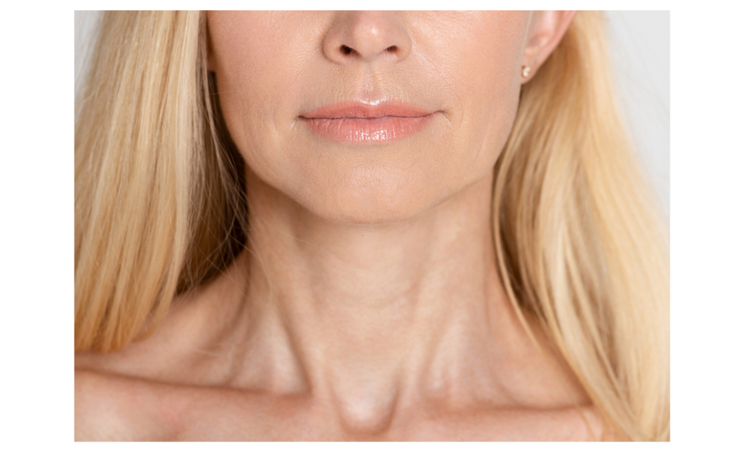 Why Your Neck Is Aging Faster Than Your Face—And How to Fix It Now