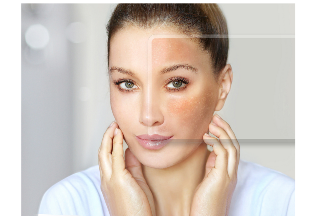 Micro-Inflammation: The Invisible Cause of Dull Skin