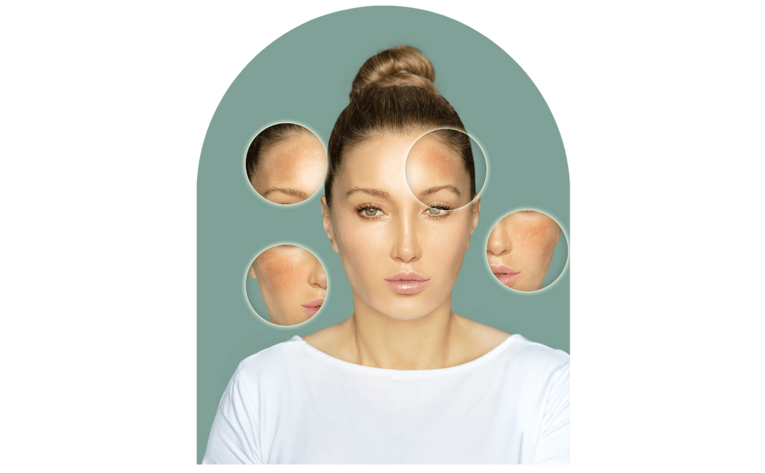 Free Radicals: What are They and How Do They Affect Your Skin?