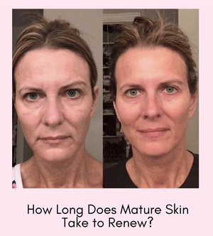 How Long Does Mature Skin Take to Renew?