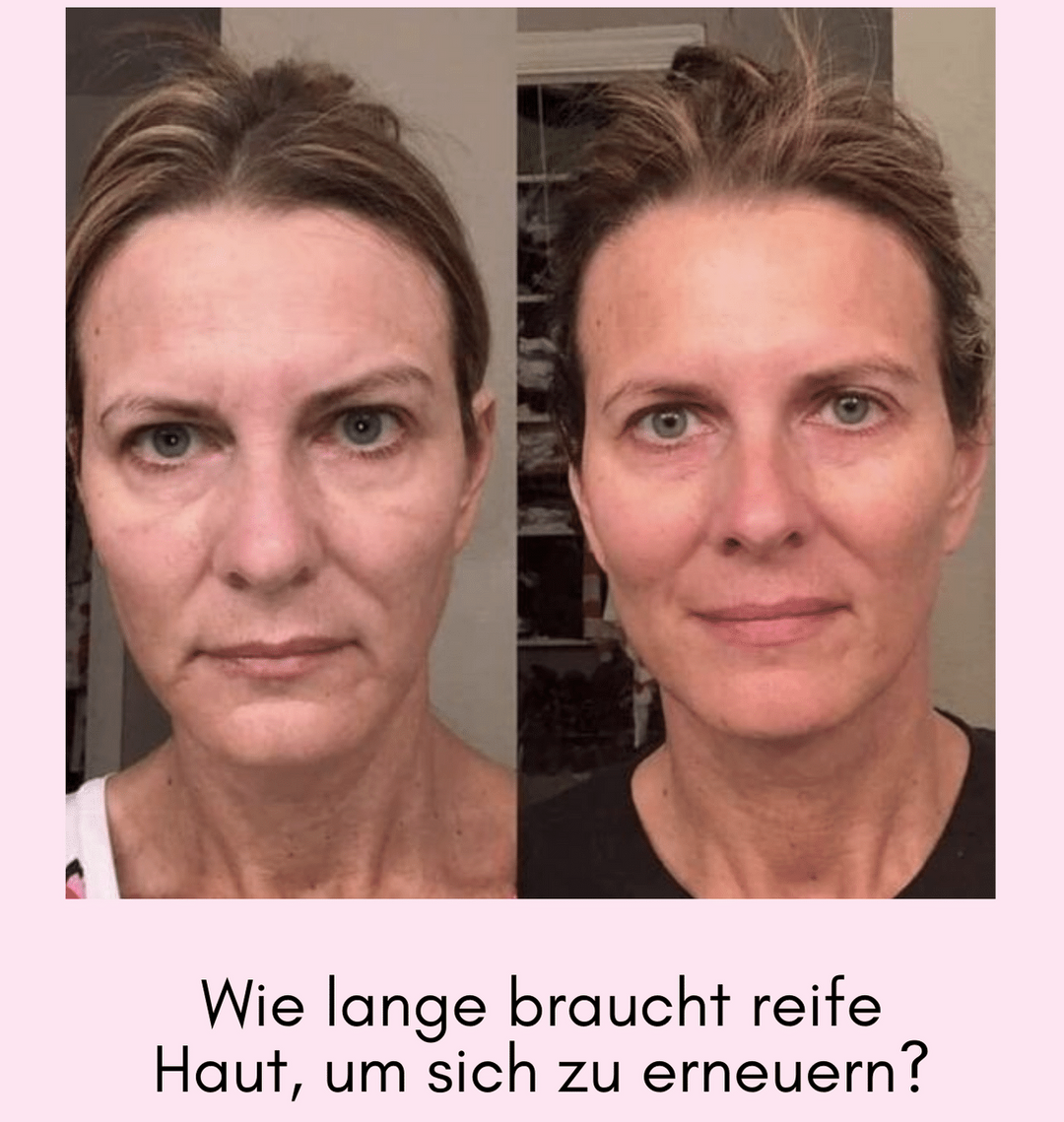 Wie lange braucht reife Haut, um sich zu erneuern?