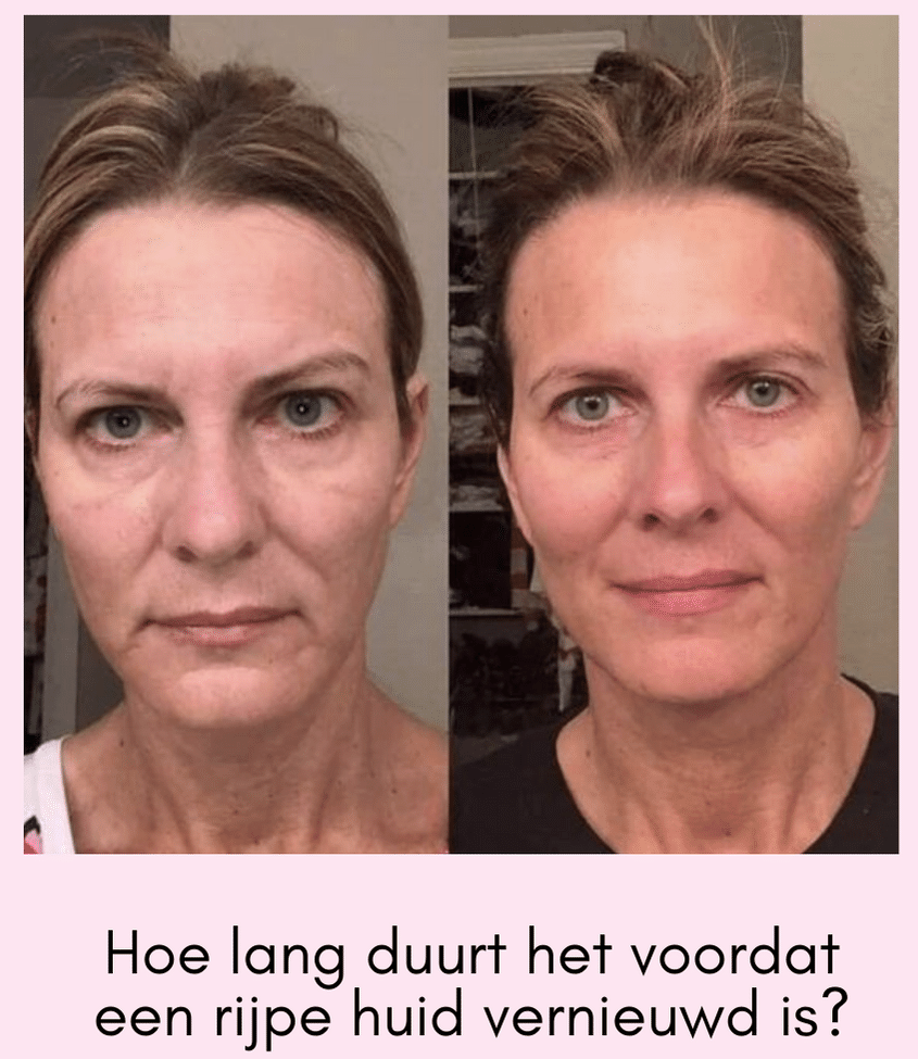 Hoe lang duurt het voordat een rijpe huid vernieuwd is?