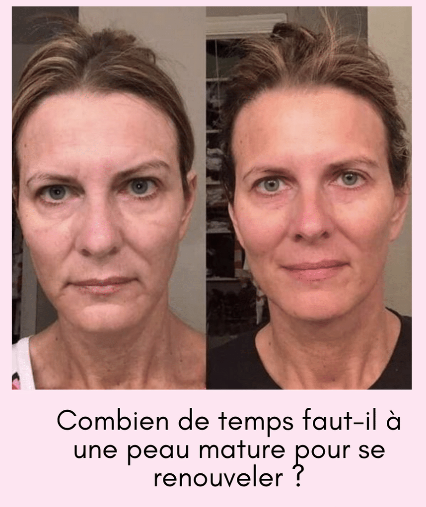 Combien de temps faut-il à une peau mature pour se régénérer ?