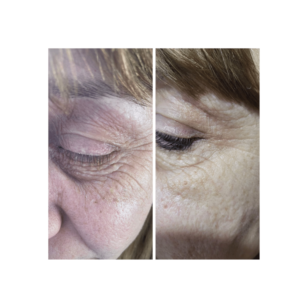 This Natural Retinol Alternative Gets Sold Out in Just Couple of Days
