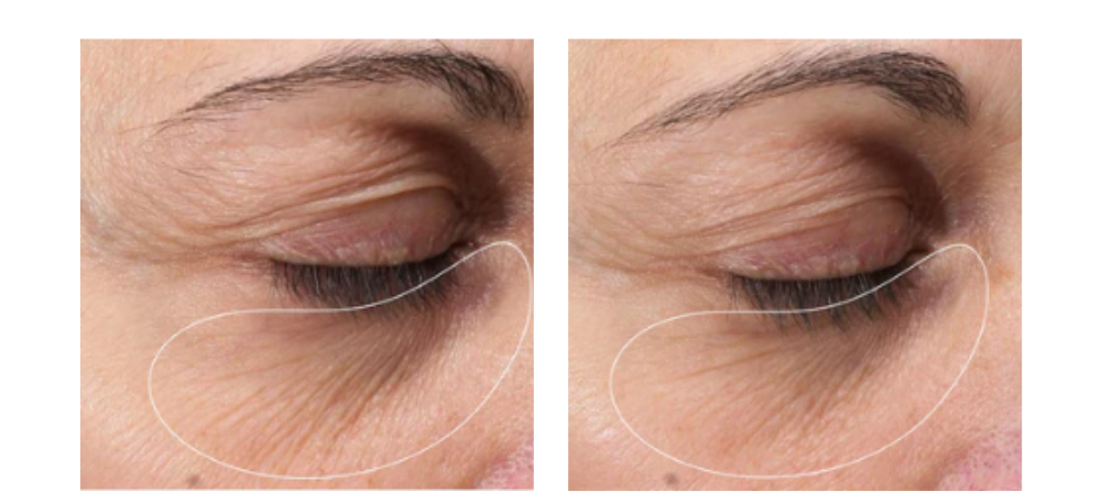 Why an Eye Cream is Essential: Debunking the Myths